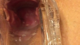 Wife speculum in pussy cervix 1